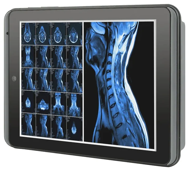 M0830W - 8" Intel Atom Z8350 Mobile Clinical Assistant (Windows)